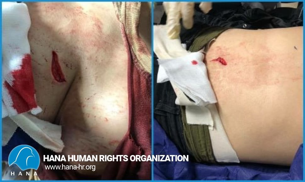 مصدومیت یک شهروند زن با ضربات چاقو توسط همسرش بە دلیل درخواست طلاق