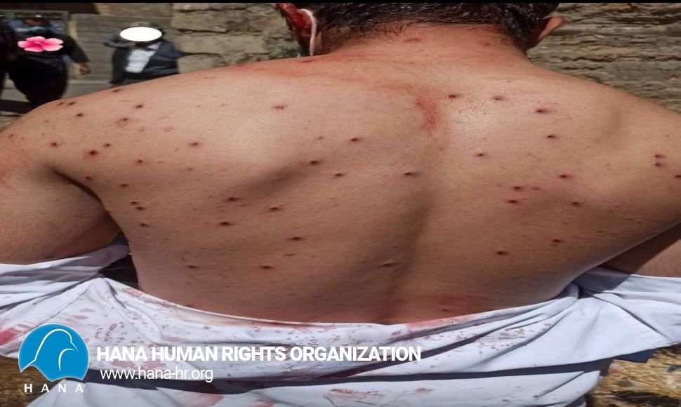 هویت یکی از مجروحان تظاهرات سقز مشخص شد