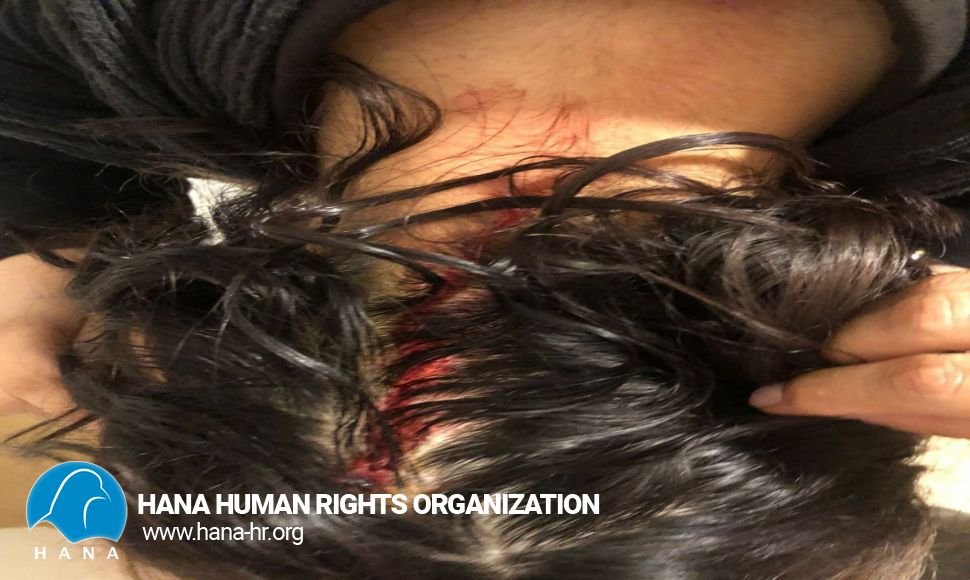 مهاباد: مجروح شدن دستکم ۱۰ شهروند