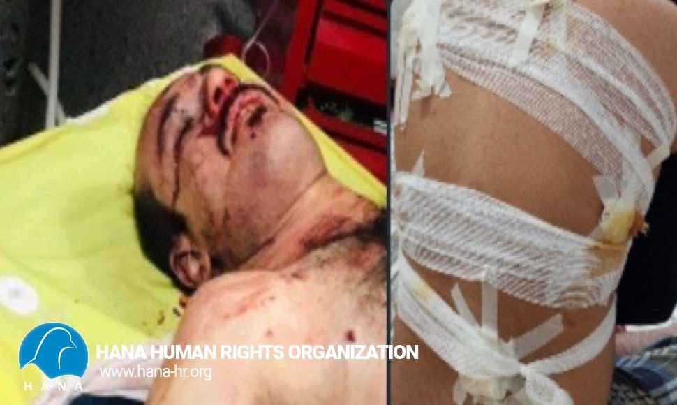 کشته و زخمی شدن سە شهروند دیگر در سقز