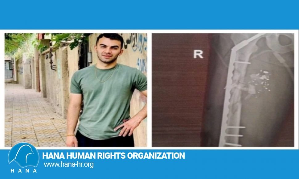 جوانرود/ مهران خرمی قدرت راە رفتن را از دست داد