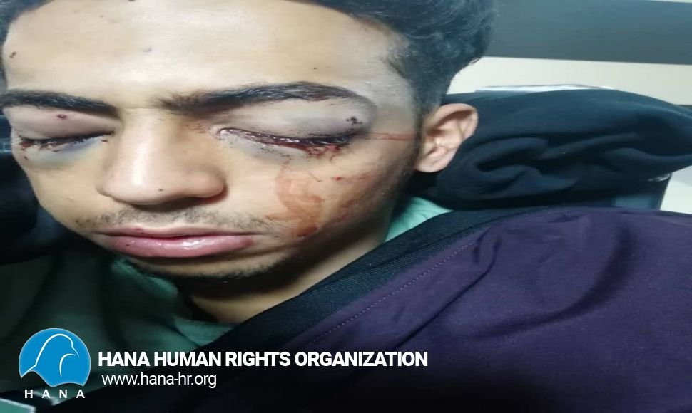 تخلیە کردن هر دو چشم یک شهروند در کرمانشاە