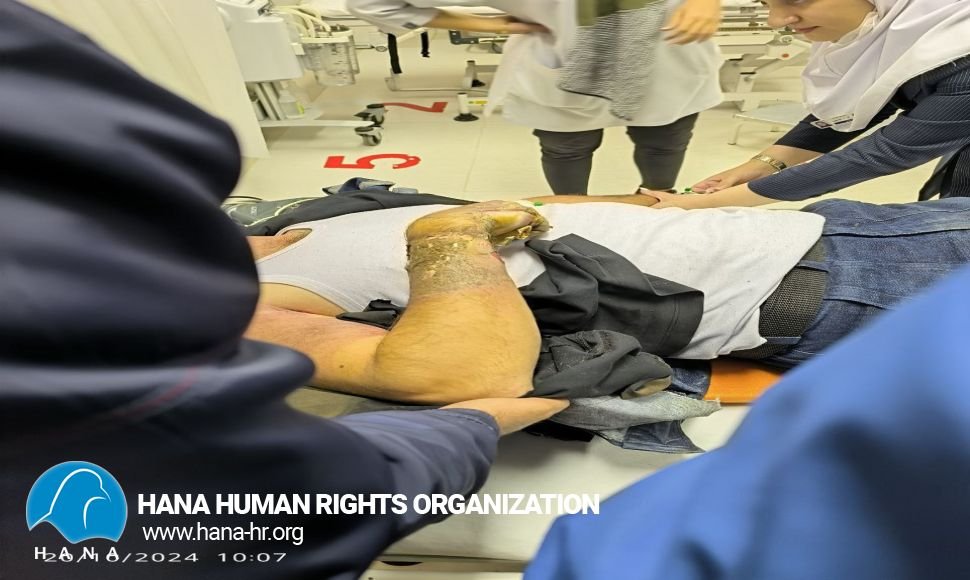 حادثە کار موجب مجروحیت شدید یک کارگر شد